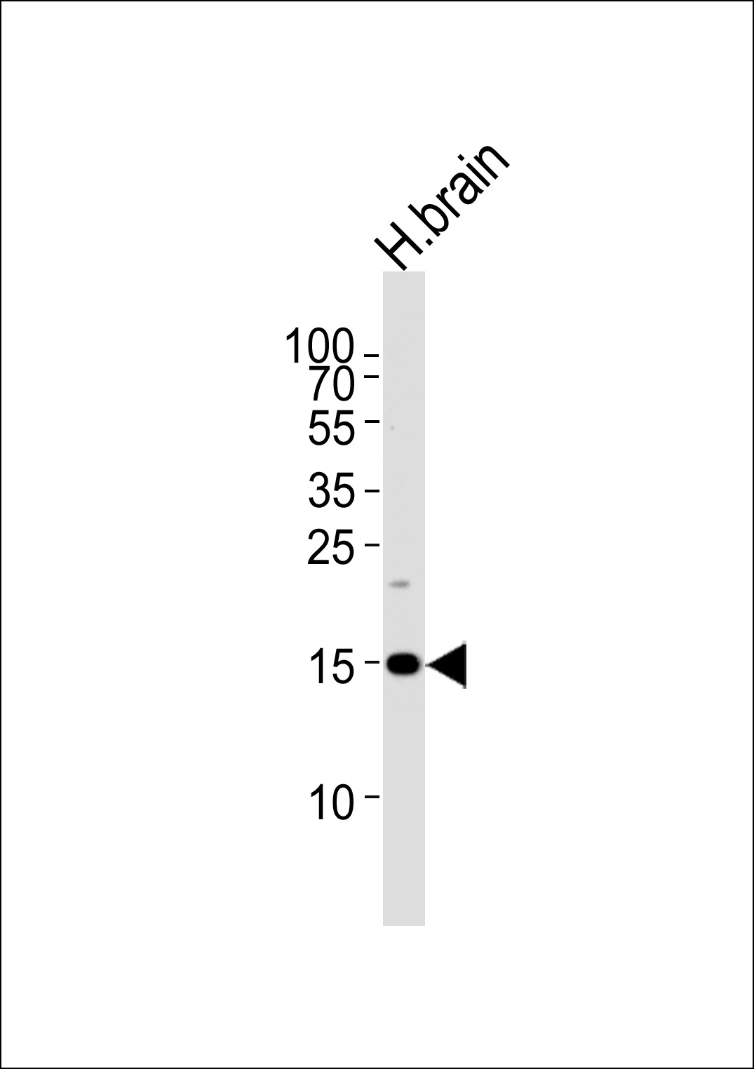 Rabbit Polyclonal Antibody to SPRN  (C-term)