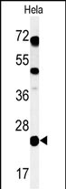 Rabbit Polyclonal Antibody to CP054  (C-term)
