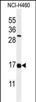 Rabbit Polyclonal Antibody to IFM2  (N-term)