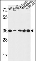 Rabbit Polyclonal Antibody to TOR1B