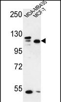 Rabbit Polyclonal Antibody to SEC24C