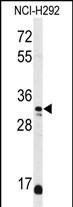 Rabbit Polyclonal Antibody to DDO