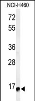 Rabbit Polyclonal Antibody to RPS13