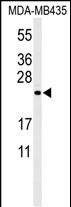 Rabbit Polyclonal Antibody to ZCH24  (C-term)
