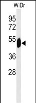 Rabbit Polyclonal Antibody to SETD6