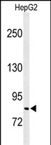 Rabbit Polyclonal Antibody to C19orf21 (N-term)