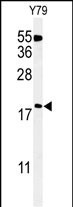 Rabbit Polyclonal Antibody to TXNDC12