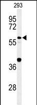 Rabbit Polyclonal Antibody to CDC45L