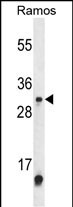 Rabbit Polyclonal Antibody to METTL1