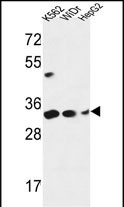 Rabbit Polyclonal Antibody to PYCR1