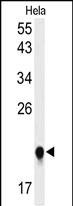 Rabbit Polyclonal Antibody to IMP3