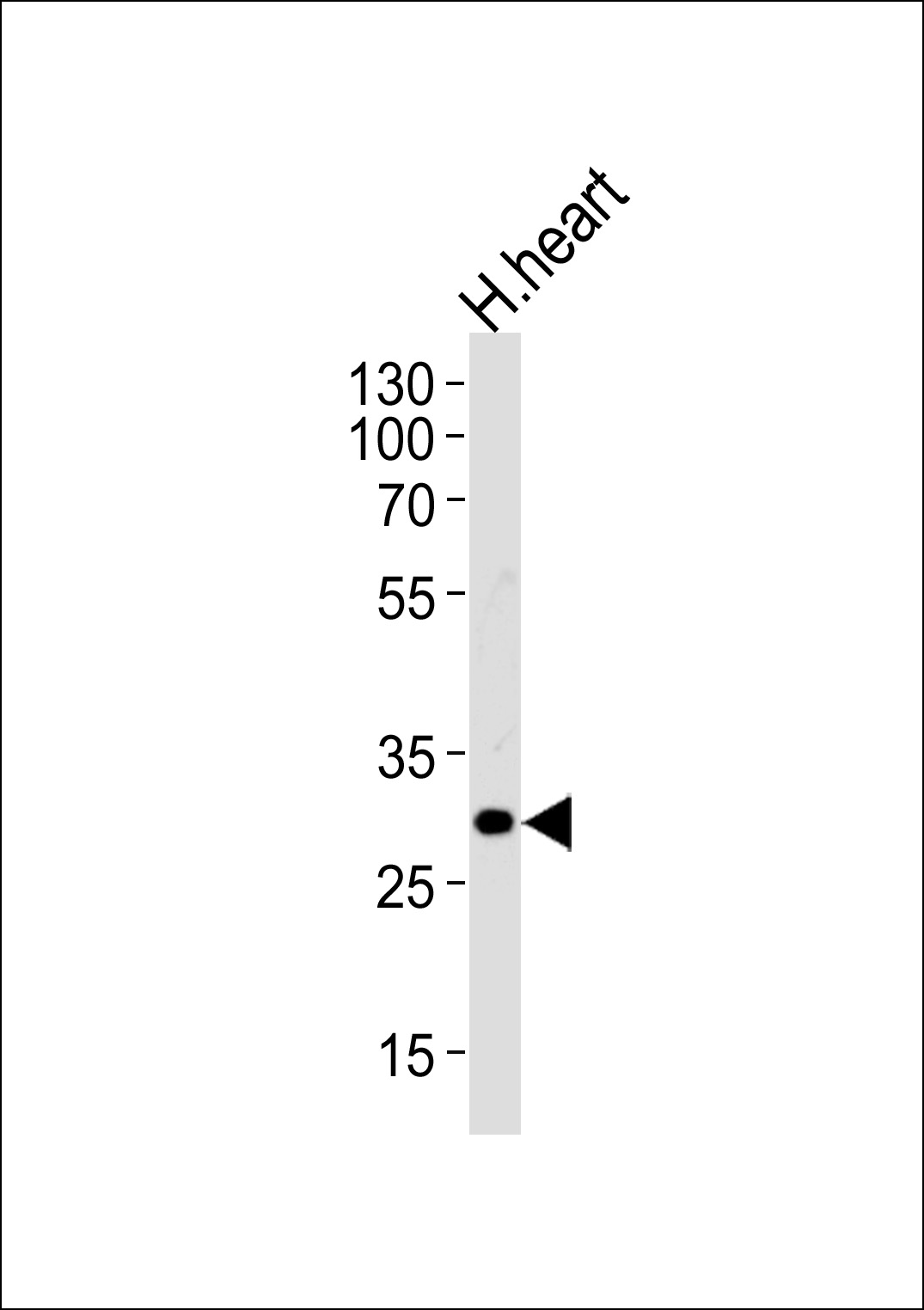 Rabbit Polyclonal Antibody to TBCD7