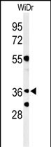 Rabbit Polyclonal Antibody to NSE4A (N-term)