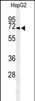 Rabbit Polyclonal Antibody to ARSI  (C-term)