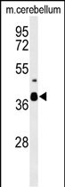 Rabbit Polyclonal Antibody to CC058