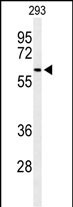 Rabbit Polyclonal Antibody to SNX27