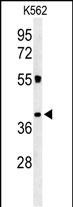 Rabbit Polyclonal Antibody to CLM1 (N-term)