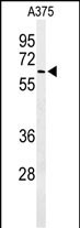 Rabbit Polyclonal Antibody to ALG10 (N-term)