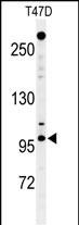 Rabbit Polyclonal Antibody to NUP210 (N-term)