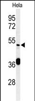 Rabbit Polyclonal Antibody to DDX49