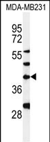 Rabbit Polyclonal Antibody to DPAGT1