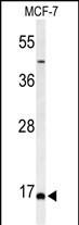 Rabbit Polyclonal Antibody to FAM44B