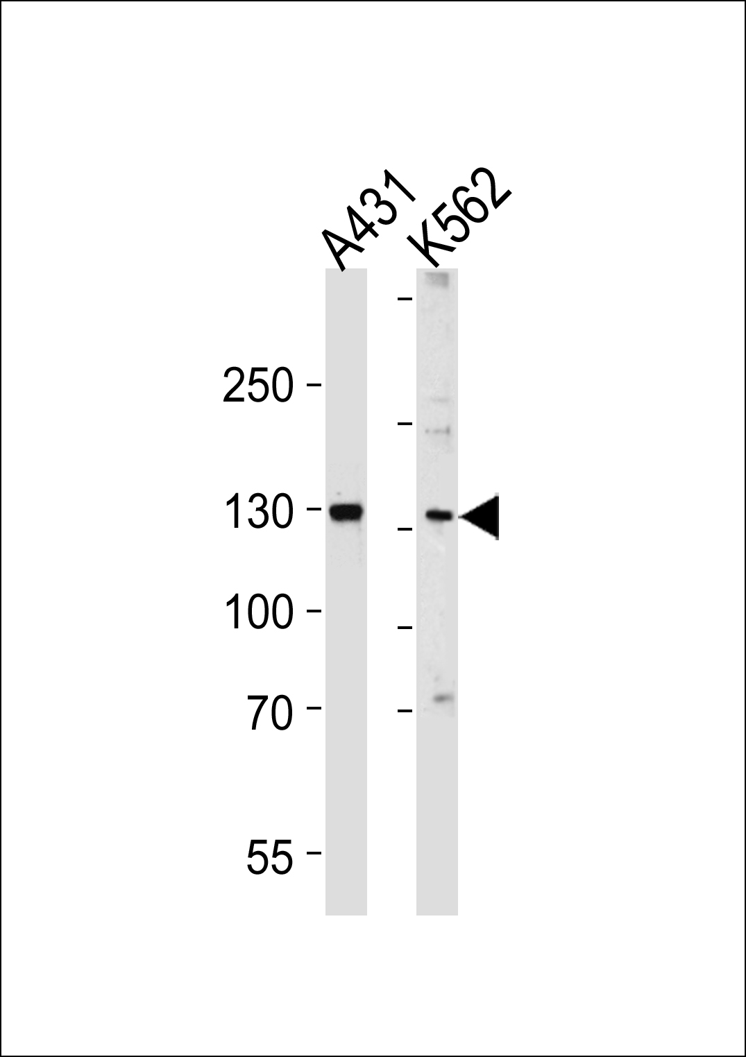 Rabbit Polyclonal Antibody to GALNT5 (N-term)