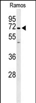 Rabbit Polyclonal Antibody to PHTNS (N-term)