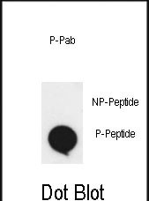 Rabbit Polyclonal Antibody to Phospho-EphA2(S897)