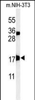 Rabbit Polyclonal Antibody to APITD1
