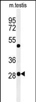 Rabbit Polyclonal Antibody to RPC8 (N-term)