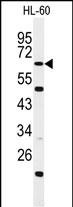 Rabbit Polyclonal Antibody to WDTC1