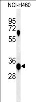 Rabbit Polyclonal Antibody to KCTD1  (C-term)