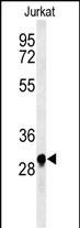 Rabbit Polyclonal Antibody to ANR49