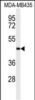 Rabbit Polyclonal Antibody to CC50B  (N-term)