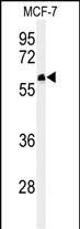 Rabbit Polyclonal Antibody to FA20A (N-term)