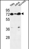 Rabbit Polyclonal Antibody to LPPR4  (C-term)