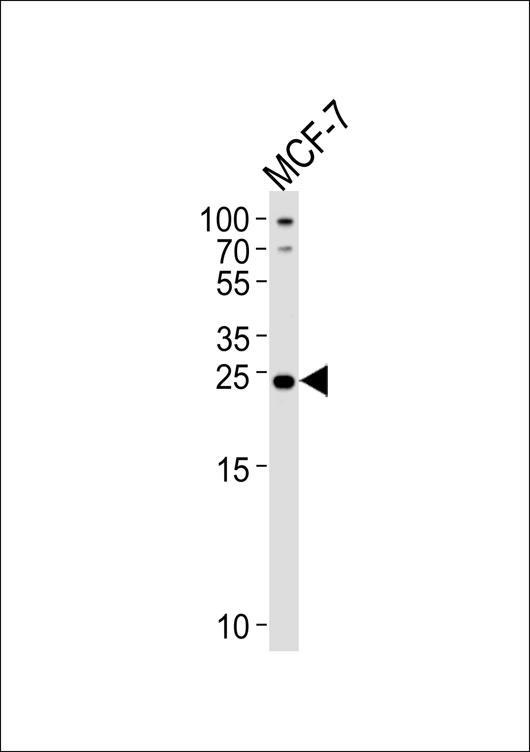 Rabbit Polyclonal Antibody to PTPLB  (C-term)