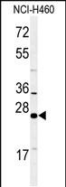 Rabbit Polyclonal Antibody to RAB27B