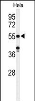 Rabbit Polyclonal Antibody to POTEH (N-term)