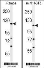 Rabbit Polyclonal Antibody to ARHGAP30