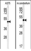 Rabbit Polyclonal Antibody to C10orf46