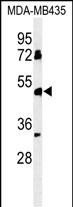 Rabbit Polyclonal Antibody to BTNL8