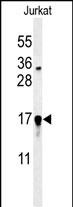 Rabbit Polyclonal Antibody to GLRX5  (C-term)