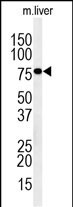 Rabbit Polyclonal Antibody to IN80D  (N-term)