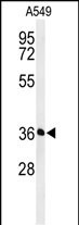 Rabbit Polyclonal Antibody to PAAF1 (N-term)