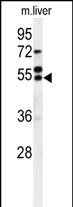 Rabbit Polyclonal Antibody to RIMKLB (N-term)