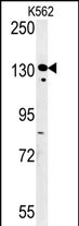 Rabbit Polyclonal Antibody to SMARCC1 (N-term)