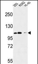 Rabbit Polyclonal Antibody to Roundabout 4 (N-term)