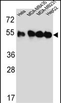 Rabbit Polyclonal Antibody to TUBB2C